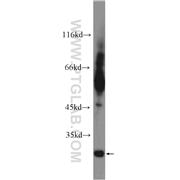 TIMP4 Rabbit Polyclonal Antibody (12326-1-AP)