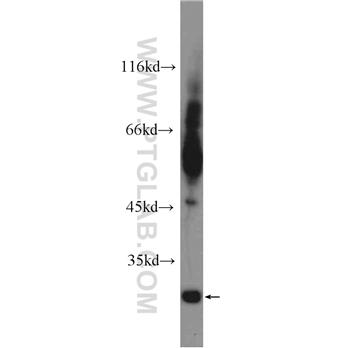 TIMP4 Rabbit Polyclonal Antibody (12326-1-AP)