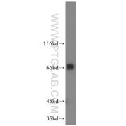 FIP1L1 Rabbit Polyclonal Antibody (12276-1-AP)
