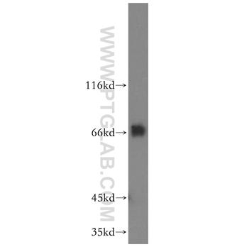 FIP1L1 Rabbit Polyclonal Antibody (12276-1-AP)