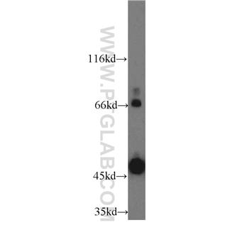 CD84 Rabbit Polyclonal Antibody (12566-1-AP)