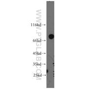 SHCBP1 Rabbit Polyclonal Antibody (12672-1-AP)