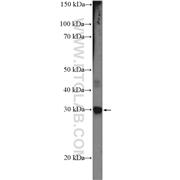 CIDEC Rabbit Polyclonal Antibody (12287-1-AP)
