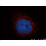 MRRF Rabbit Polyclonal Antibody (12357-2-AP)