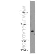TRIM23 Rabbit Polyclonal Antibody (12607-1-AP)