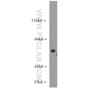 TRIM23 Rabbit Polyclonal Antibody (12607-1-AP)