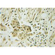 DNAJC12 Rabbit Polyclonal Antibody (12338-1-AP)