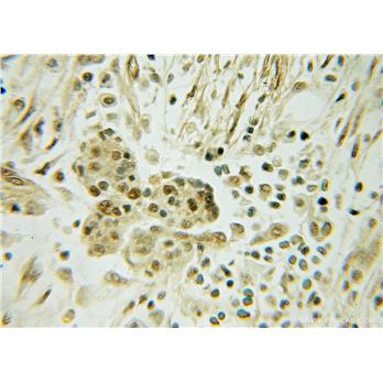 DNAJC12 Rabbit Polyclonal Antibody (12338-1-AP)