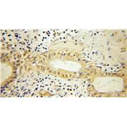 SHC1 Rabbit Polyclonal Antibody (12496-1-AP)