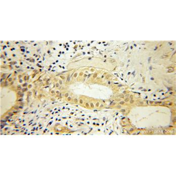 SHC1 Rabbit Polyclonal Antibody (12496-1-AP)