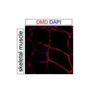 DMD Rabbit Polyclonal Antibody (12715-1-AP)