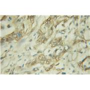 HNF1B Rabbit Polyclonal Antibody (12533-1-AP)