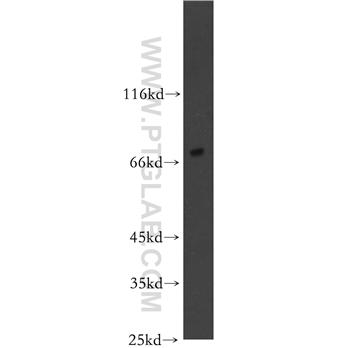 SHC4 Rabbit Polyclonal Antibody (12641-1-AP)