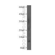 SELK Rabbit Polyclonal Antibody (12561-1-AP)