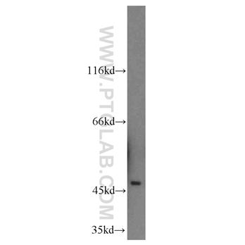 SERPINI1 Rabbit Polyclonal Antibody (12558-1-AP)