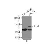 P4HA1 Rabbit Polyclonal Antibody (12658-1-AP)