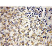 UQCRH Rabbit Polyclonal Antibody (12364-1-AP)