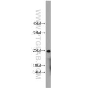 ALKBH3 Rabbit Polyclonal Antibody (12292-1-AP)