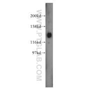PER3 Rabbit Polyclonal Antibody (12550-1-AP)