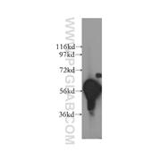 DYRK1B Rabbit Polyclonal Antibody (12240-1-AP)