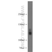 SLC4A8 Rabbit Polyclonal Antibody (12531-1-AP)