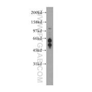 RBBP8 Rabbit Polyclonal Antibody (12624-1-AP)