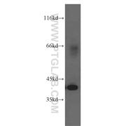 OGN Rabbit Polyclonal Antibody (12755-1-AP)