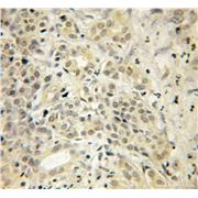 UCHL3 Rabbit Polyclonal Antibody (12384-1-AP)