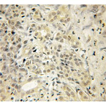 UCHL3 Rabbit Polyclonal Antibody (12384-1-AP)
