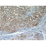 PANK3 Rabbit Polyclonal Antibody (12466-1-AP)
