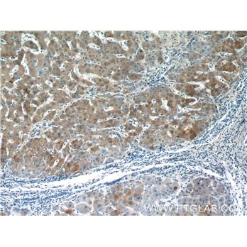 PANK3 Rabbit Polyclonal Antibody (12466-1-AP)