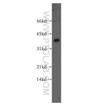 PPP2CB Rabbit Polyclonal Antibody (12554-2-AP)