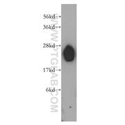 LIN7B Rabbit Polyclonal Antibody (12732-1-AP)