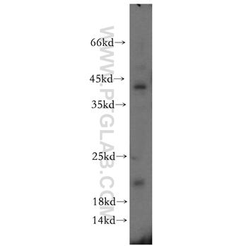 ITGB1BP1 Rabbit Polyclonal Antibody (12300-1-AP)