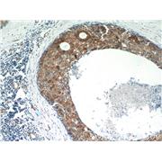 CAST Rabbit Polyclonal Antibody (12250-1-AP)