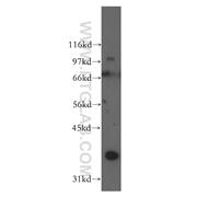 DAZL Rabbit Polyclonal Antibody (12633-1-AP)
