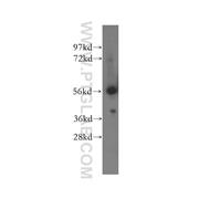 OXCT1 Rabbit Polyclonal Antibody (12175-1-AP)