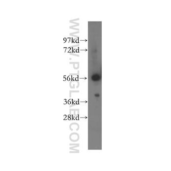 OXCT1 Rabbit Polyclonal Antibody (12175-1-AP)