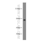 LGI1 Rabbit Polyclonal Antibody (12483-1-AP)