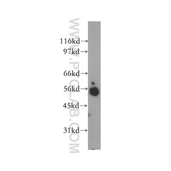 SYT4 Rabbit Polyclonal Antibody (12642-1-AP)
