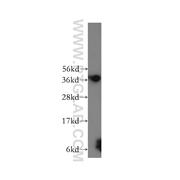 MTHFD2 Rabbit Polyclonal Antibody (12270-1-AP)