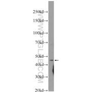 ASCC1 Rabbit Polyclonal Antibody (12301-1-AP)