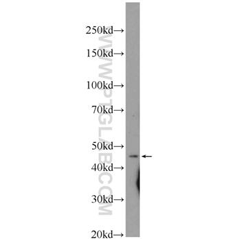 ASCC1 Rabbit Polyclonal Antibody (12301-1-AP)