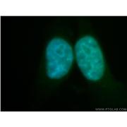 RECQL5 Rabbit Polyclonal Antibody (12468-2-AP)