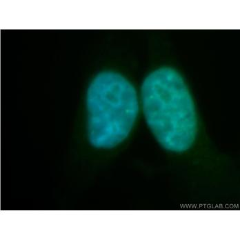 RECQL5 Rabbit Polyclonal Antibody (12468-2-AP)