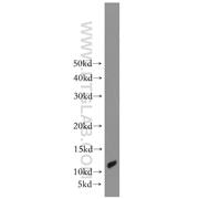 ACYP2 Rabbit Polyclonal Antibody (12302-1-AP)