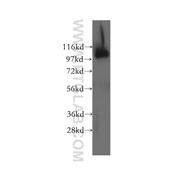 OSBPL3 Rabbit Polyclonal Antibody (12417-1-AP)