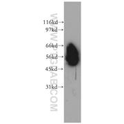 CD46 Rabbit Polyclonal Antibody (12494-1-AP)