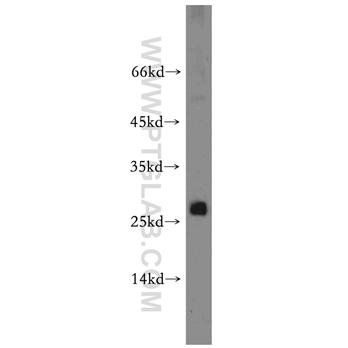 PTTG1IP Rabbit Polyclonal Antibody (12575-1-AP)