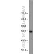 PPID Rabbit Polyclonal Antibody (12716-1-AP)